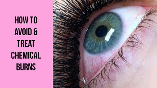 How To Avoid & Treat Chemical Burns From Eyelash Extensions: Lash Tech Guide